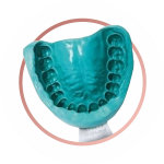 оттиск челюсти для съёмного протеза